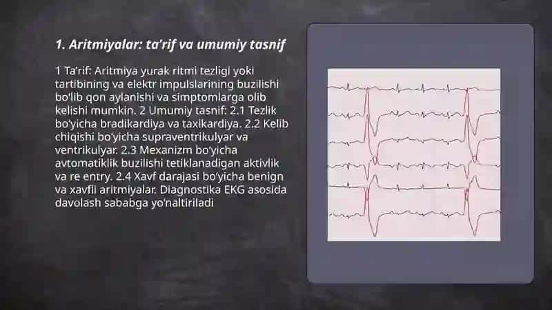 Aritmiyalar va ularning turlari 3