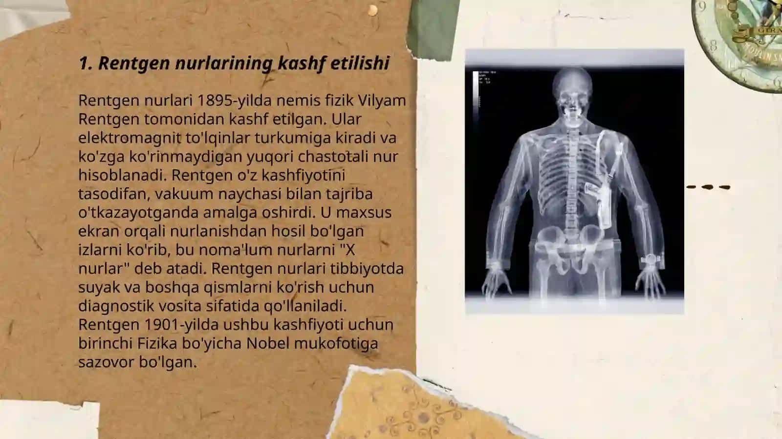 Rentgen nurlarini o‘rganish tarixi, suyak va bo‘gimlarning rivojlanishini rentgen nurlari yordamida o‘rganish 3