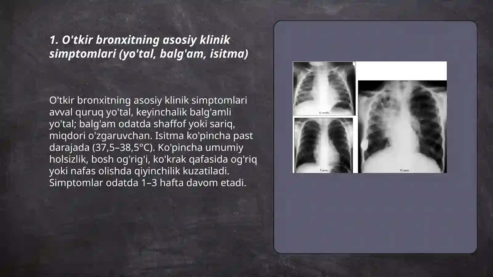 Bronxitlar: O'tkir va surunkali bronxitlar simptomatologiyasi, diagnostik kriteriyalari 3