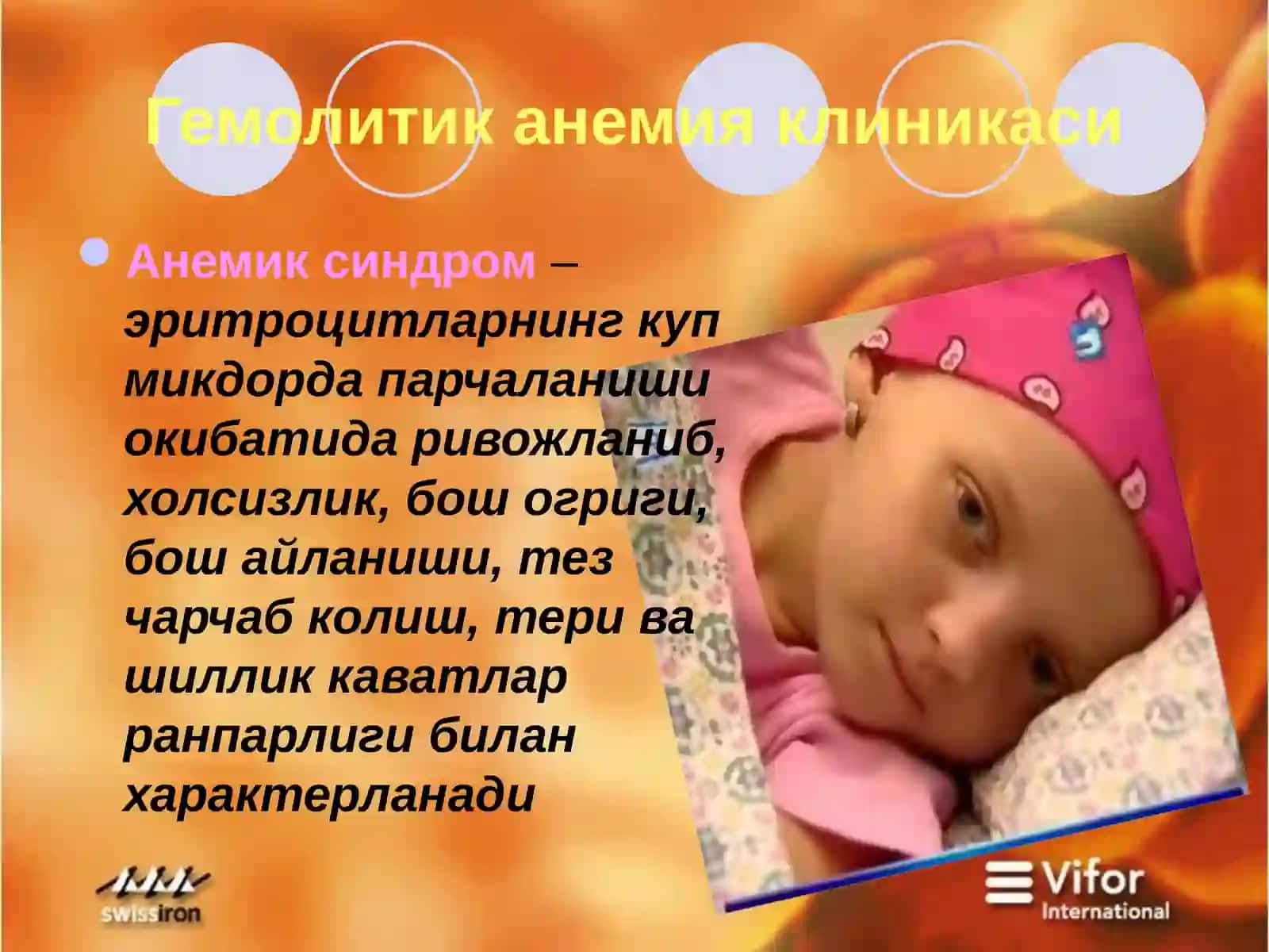 Гемолитик анемия 3