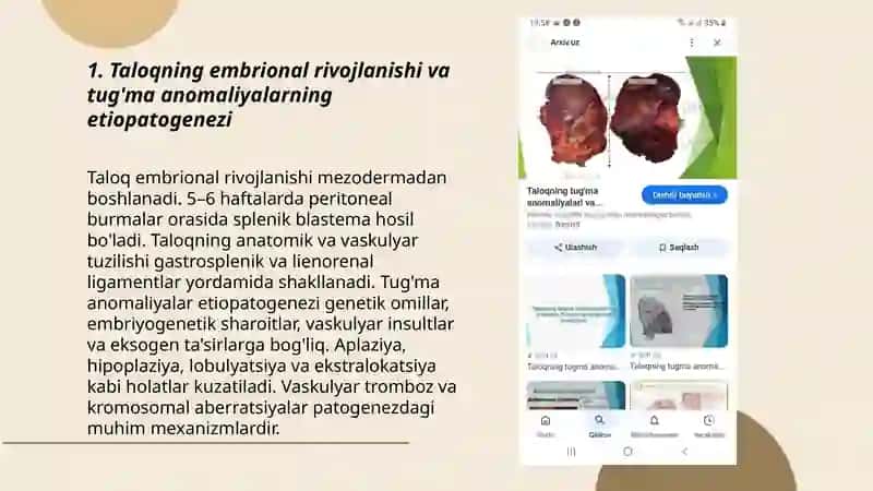 Taloqning tuģma anomaliyalari va òsmalari. Timusning rivojlanish buzilishlari 3