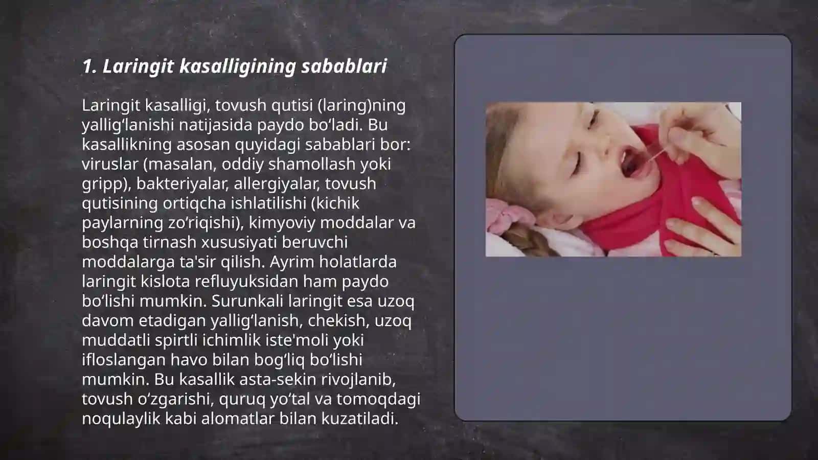 Bolalardagi laringit kasalligi va davolash choralari 3