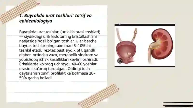Buyrakda urat toshlari: taʼrif va epidemiologiya 3