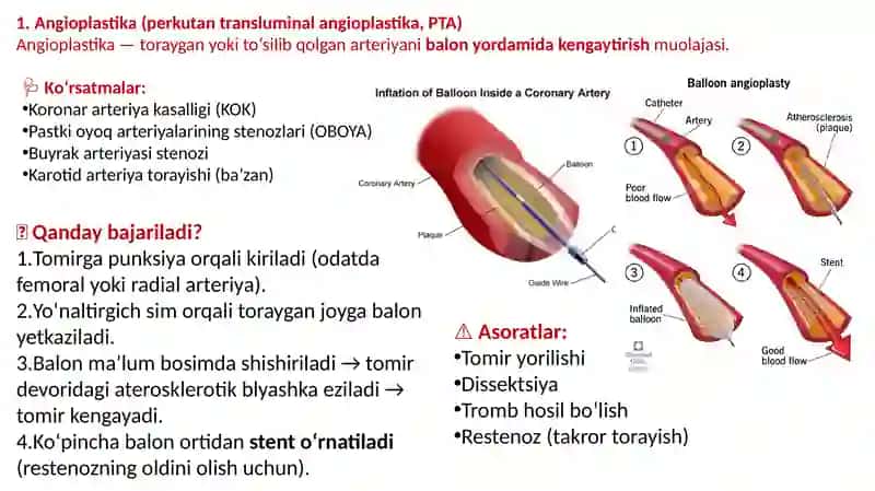 Endovaskulyar operatsiyalar. O‘mrov osti va son venalarini punksiyaqilish va kateterlash. Mikroxirurgik texnika. Transplantologiyadamikroxirurgiyaning qo‘llanilishi. 3