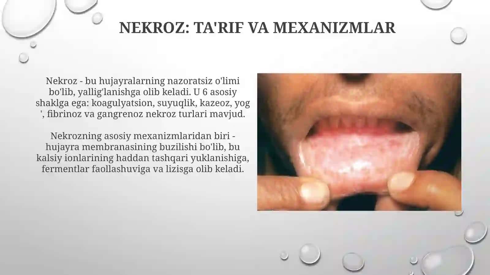 Nekroz va Apoptoz: Asosiy Tushunchalar va Mexanizmlar 3