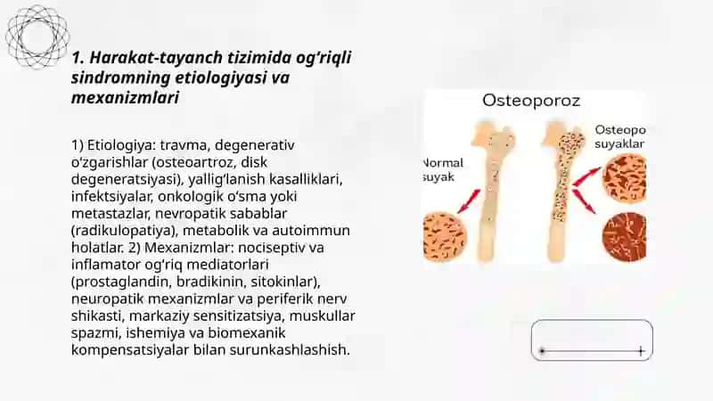 Harakat-tayanch tizimida og'riqli sindromi 3
