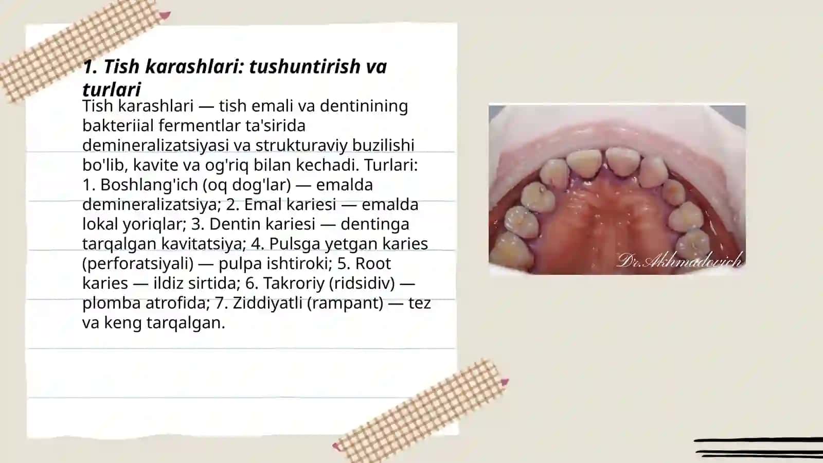 Tish karashlari. Davolash usullari. Kelib chiqishi 3