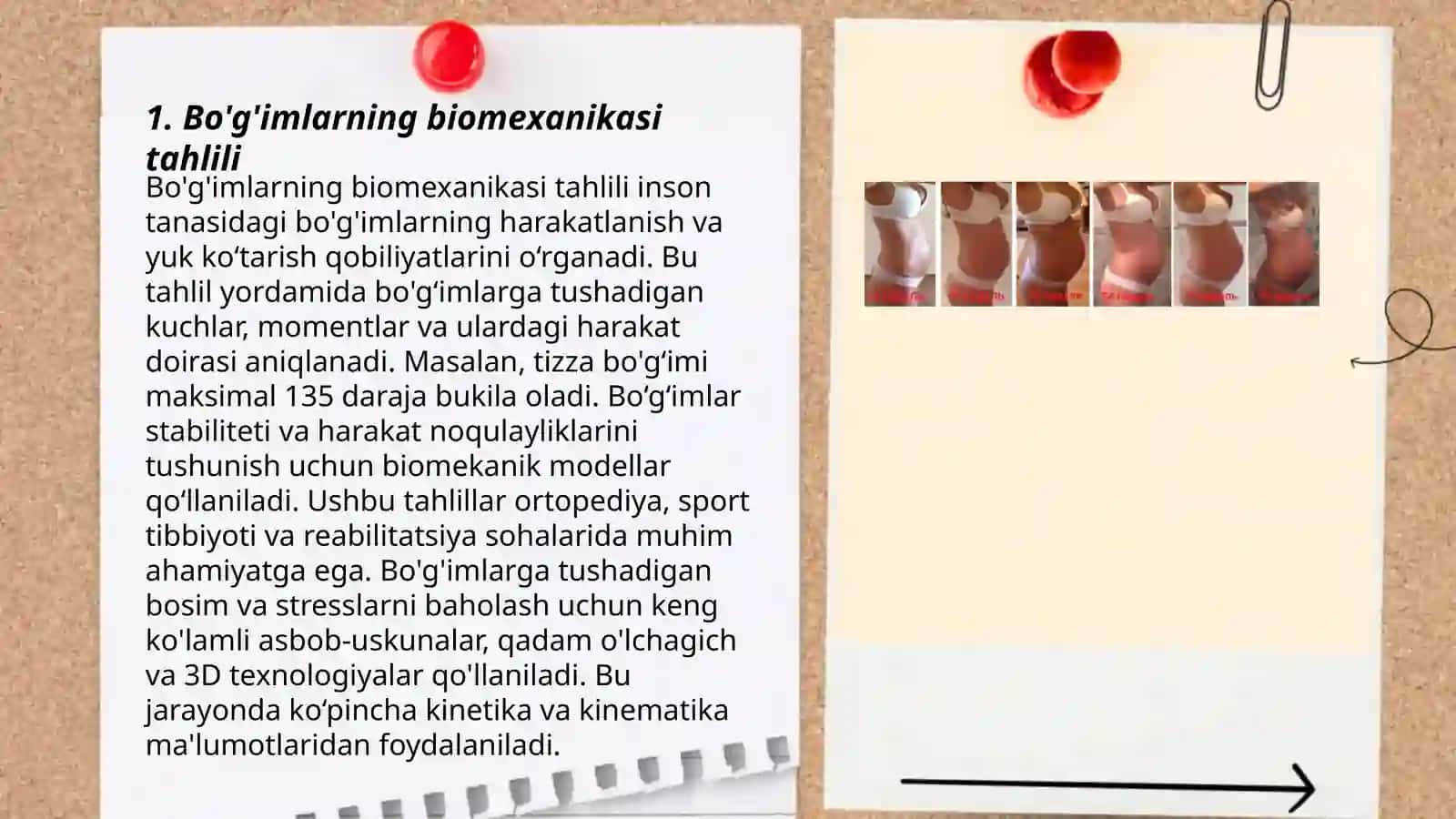 Bo'g'imlarning biomexanikasi, Birlashmalarning rentgenanatomiyasi 3