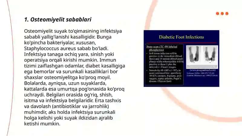 Osteomiyelit kasalligi 3