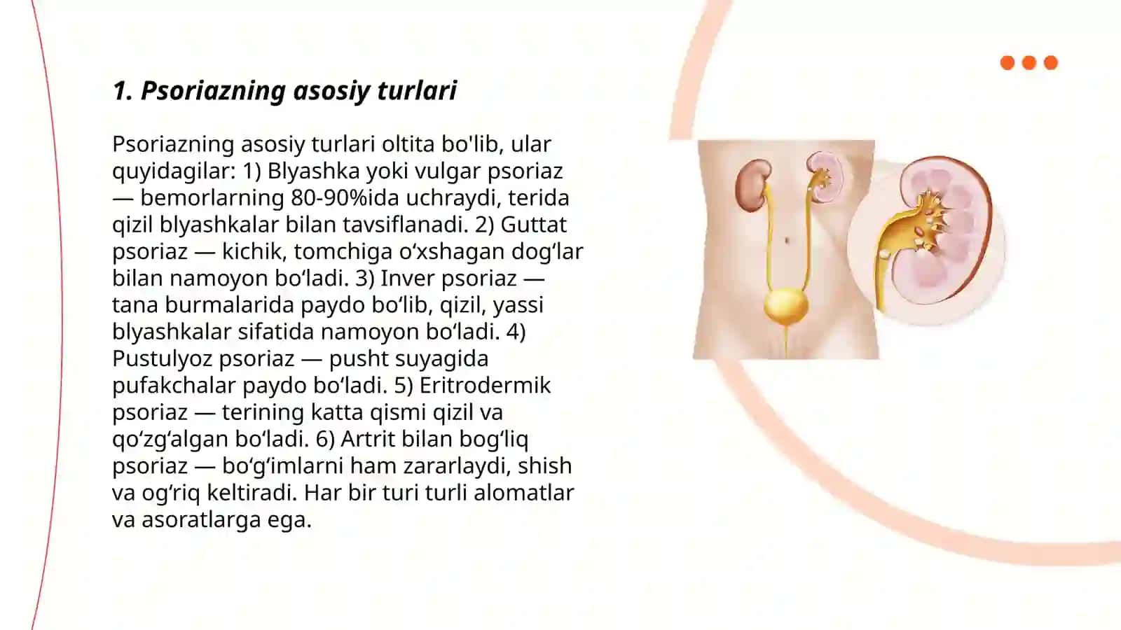 Psoriaz kasalligining turlari, kelib chiqish sabablari va davolash choralari rasimlari bilan 3