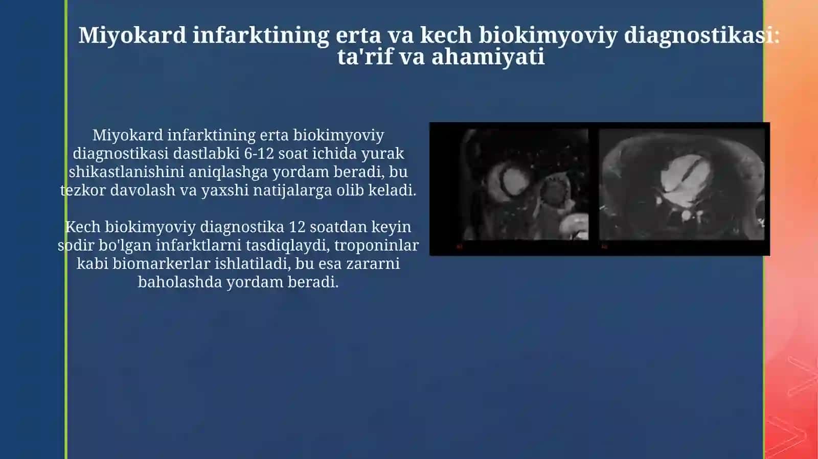 Miokard infarktining erta va kech biokimyoviy tashxisi 3
