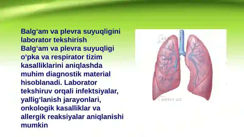 O‘T TOSH KASALLIGI (Xolelitiaz) 3