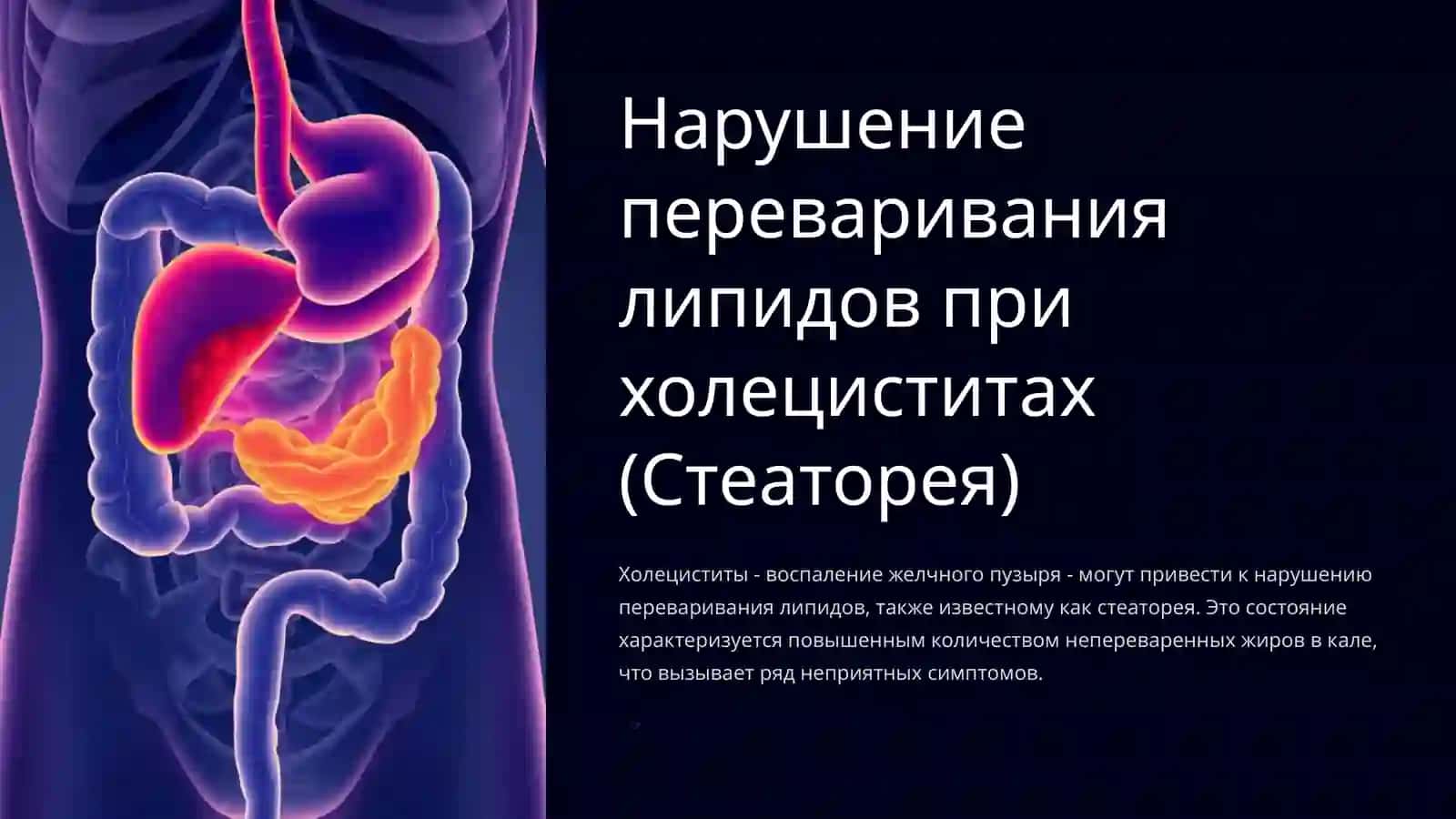 Нарушениеперевариваниялипидовприхолециститах(Стеаторея) 3