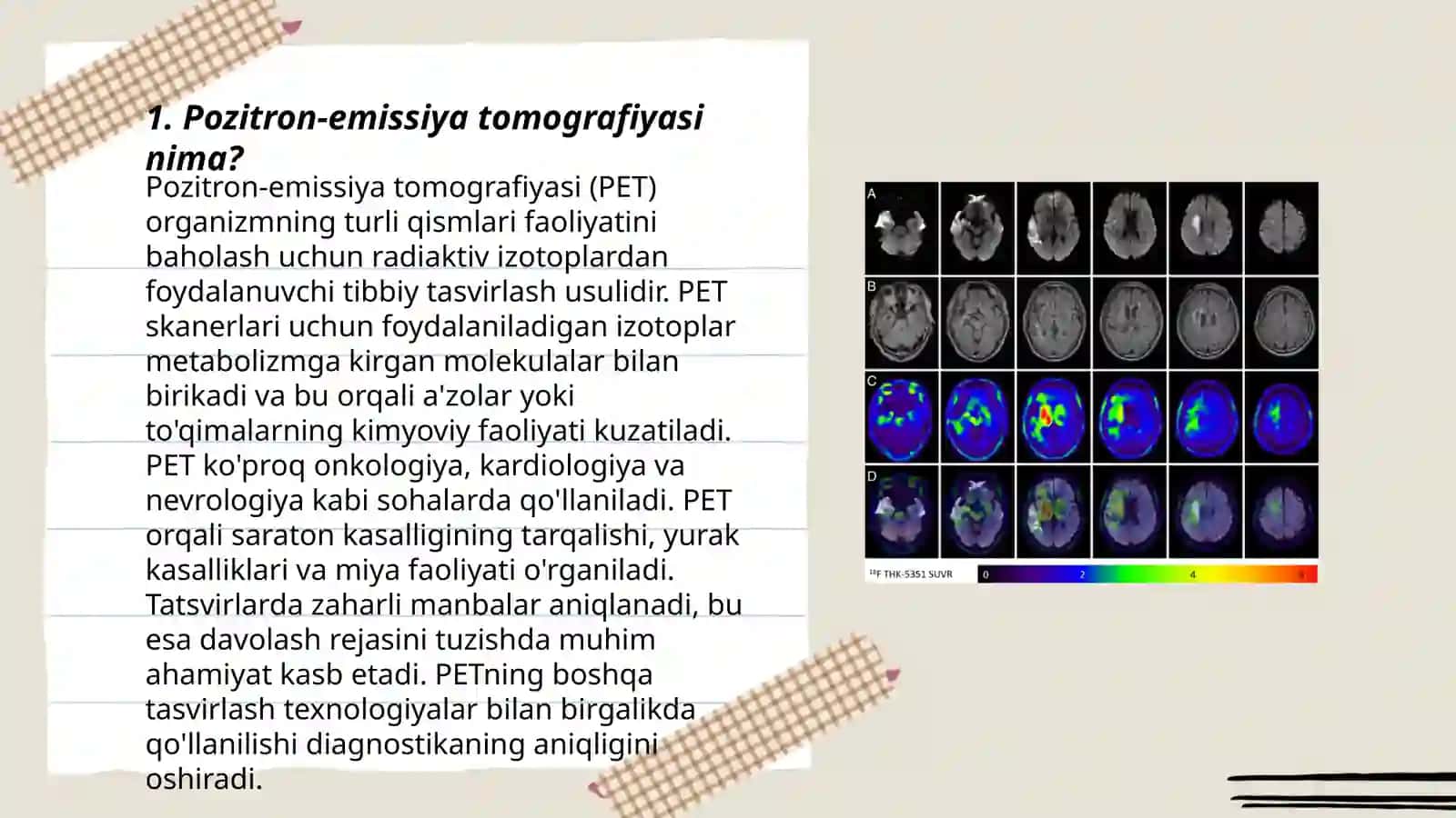 Pazitron-emmission tomografiya 3