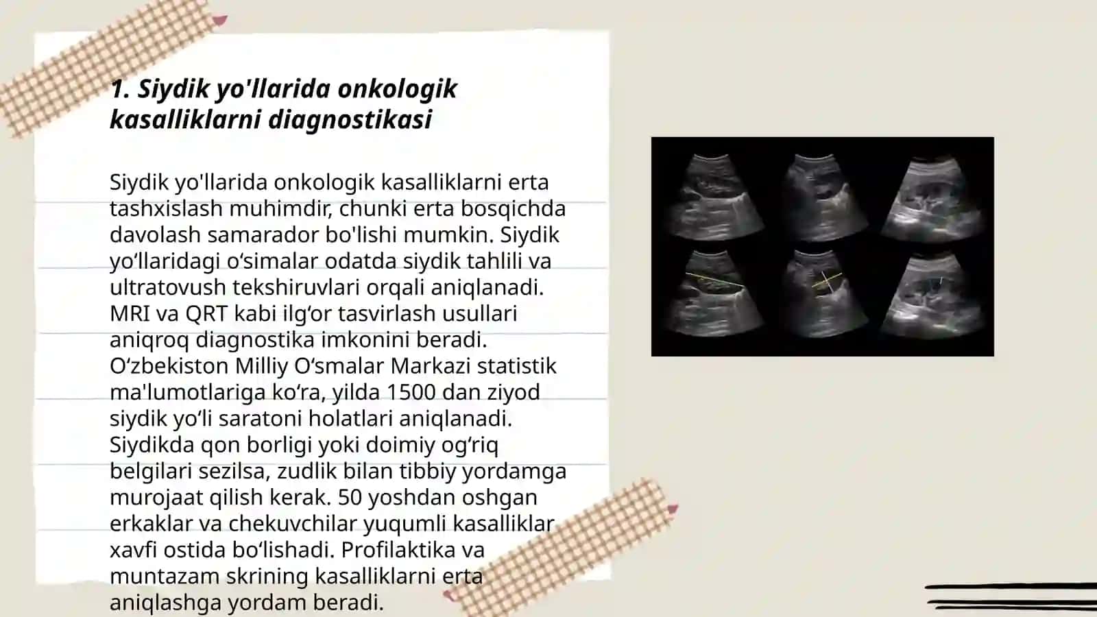 Siydik yo'llarida onkologik kasalliklarni Radiologik tekshirishlar 3