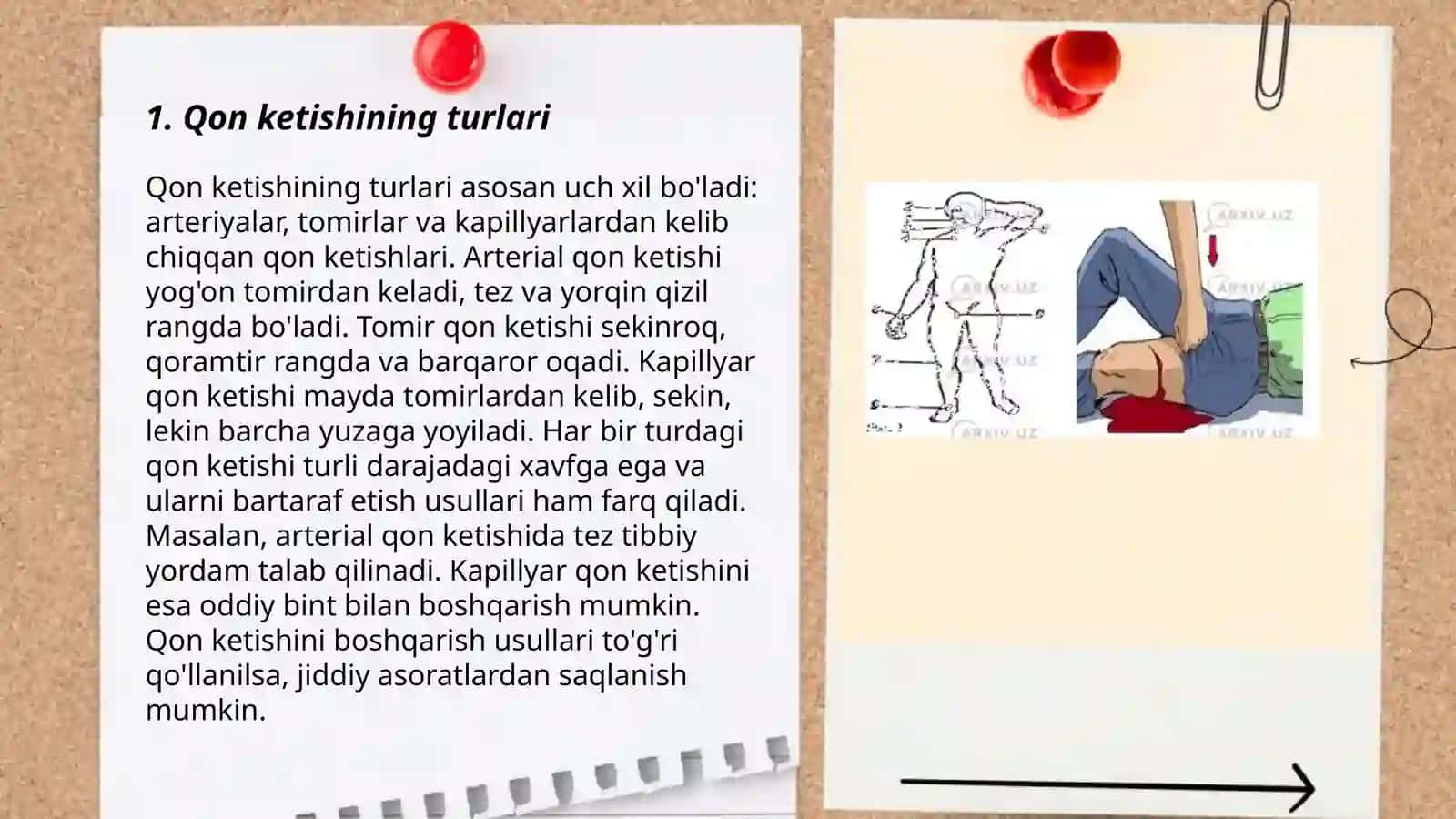 Qon ketishining turlari 3