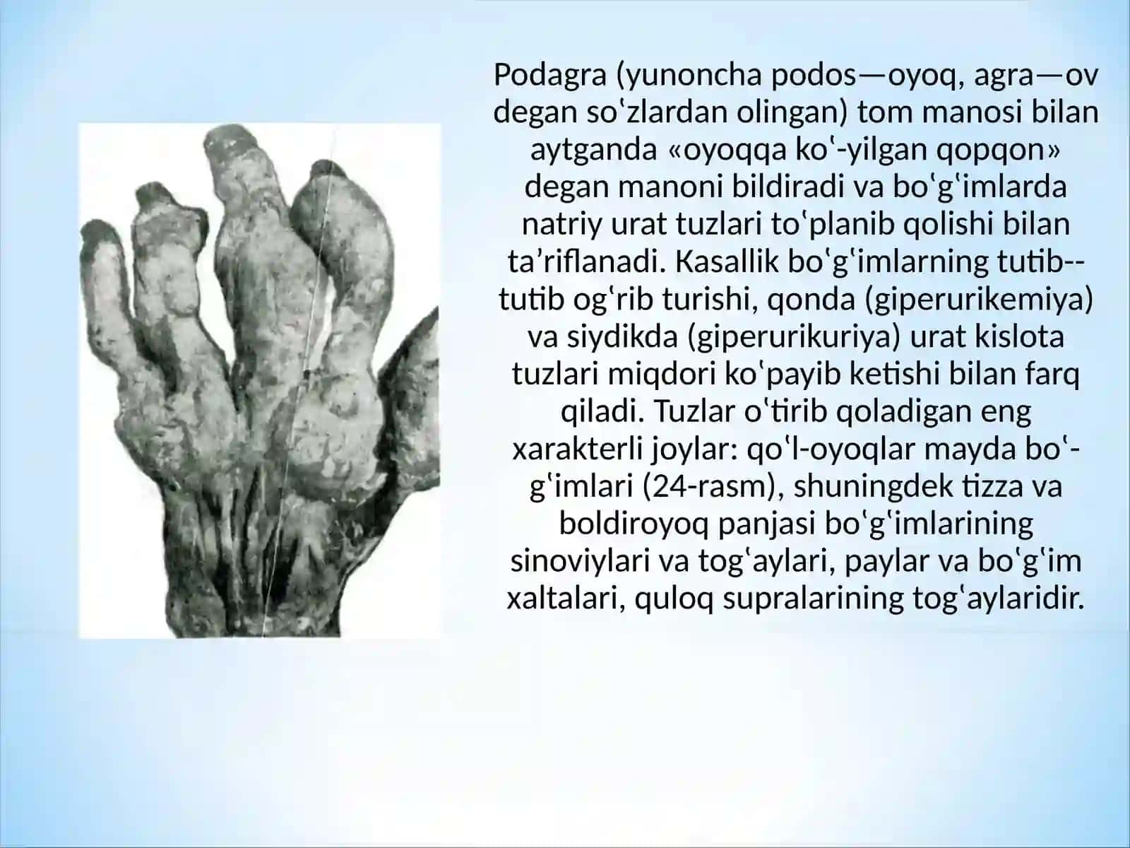 Tosh kasalliklarining kimyoviy asoslari 3