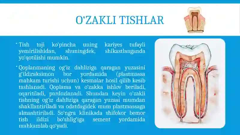 O‘ZAKLI TISHLAR TAYYORLASH TEXNOLOGIYASI 3