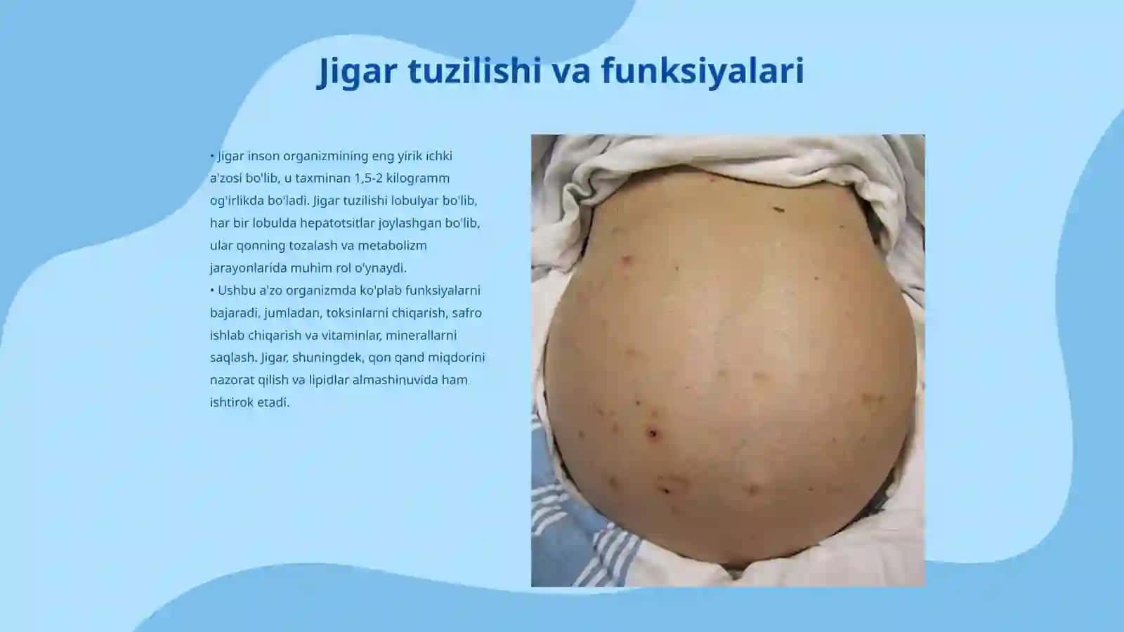 Jigarni Kurlov boʻyicha perkussiyasi 3