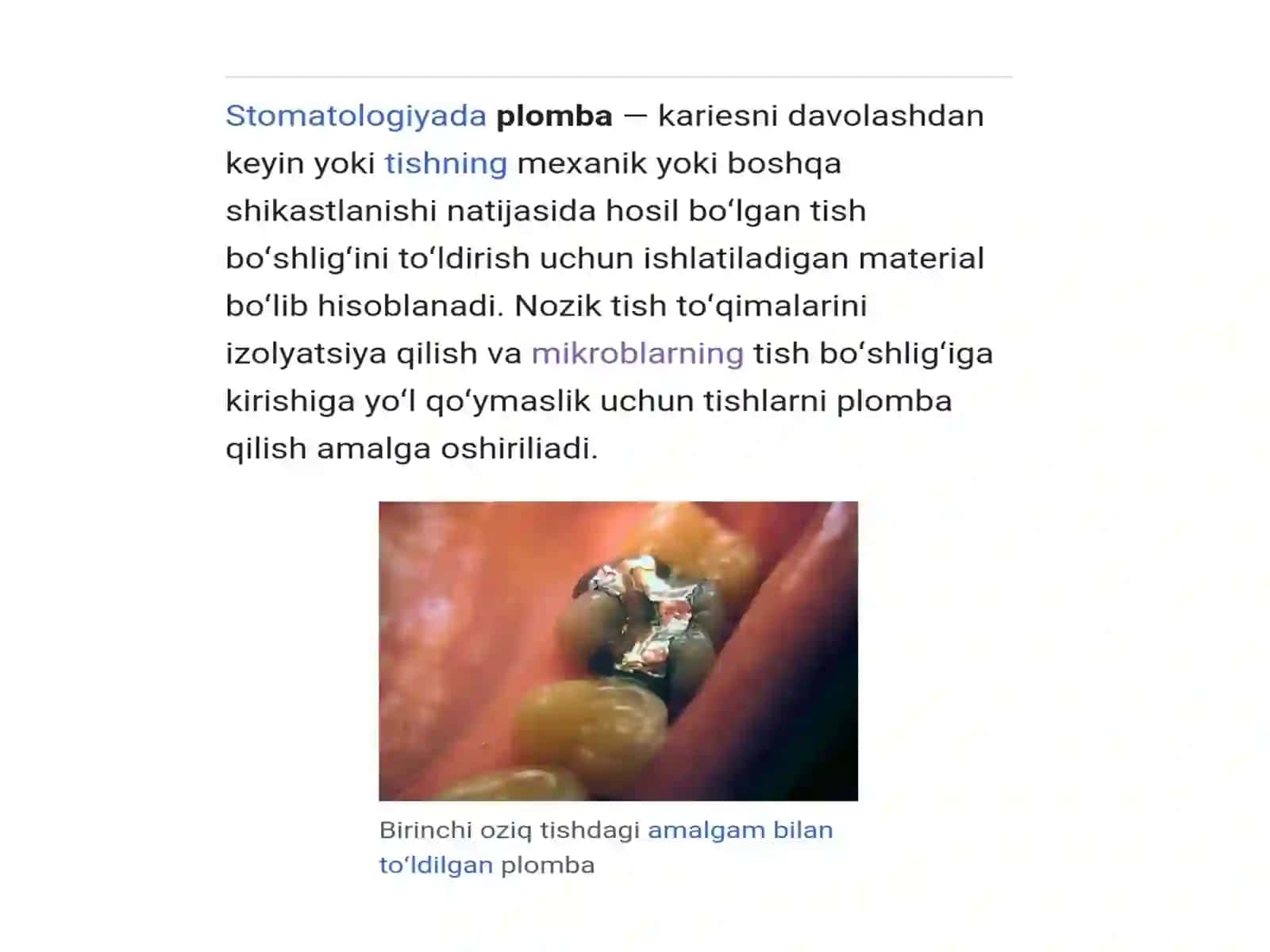 stomatologik plomba ashiyolar, ularning turlari, tasnifi, ularga bo`lgan zamonaviy talablar 3