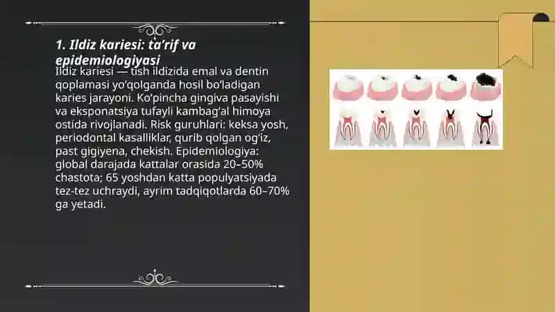 Ildiz kariesi: klinikasi, tashxislash, davolash 3