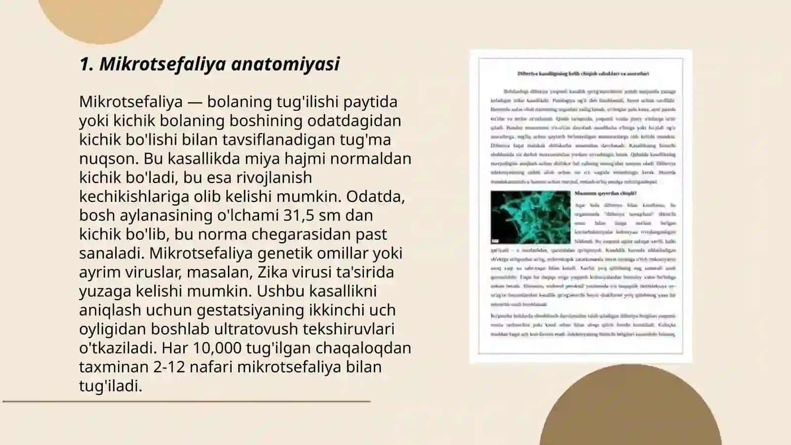 Mikrotsefaliyaning kelib chiqish sabablari va asoratlari. Rustamova Gullola 3