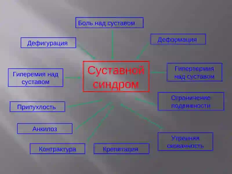 Суставной синдром 3