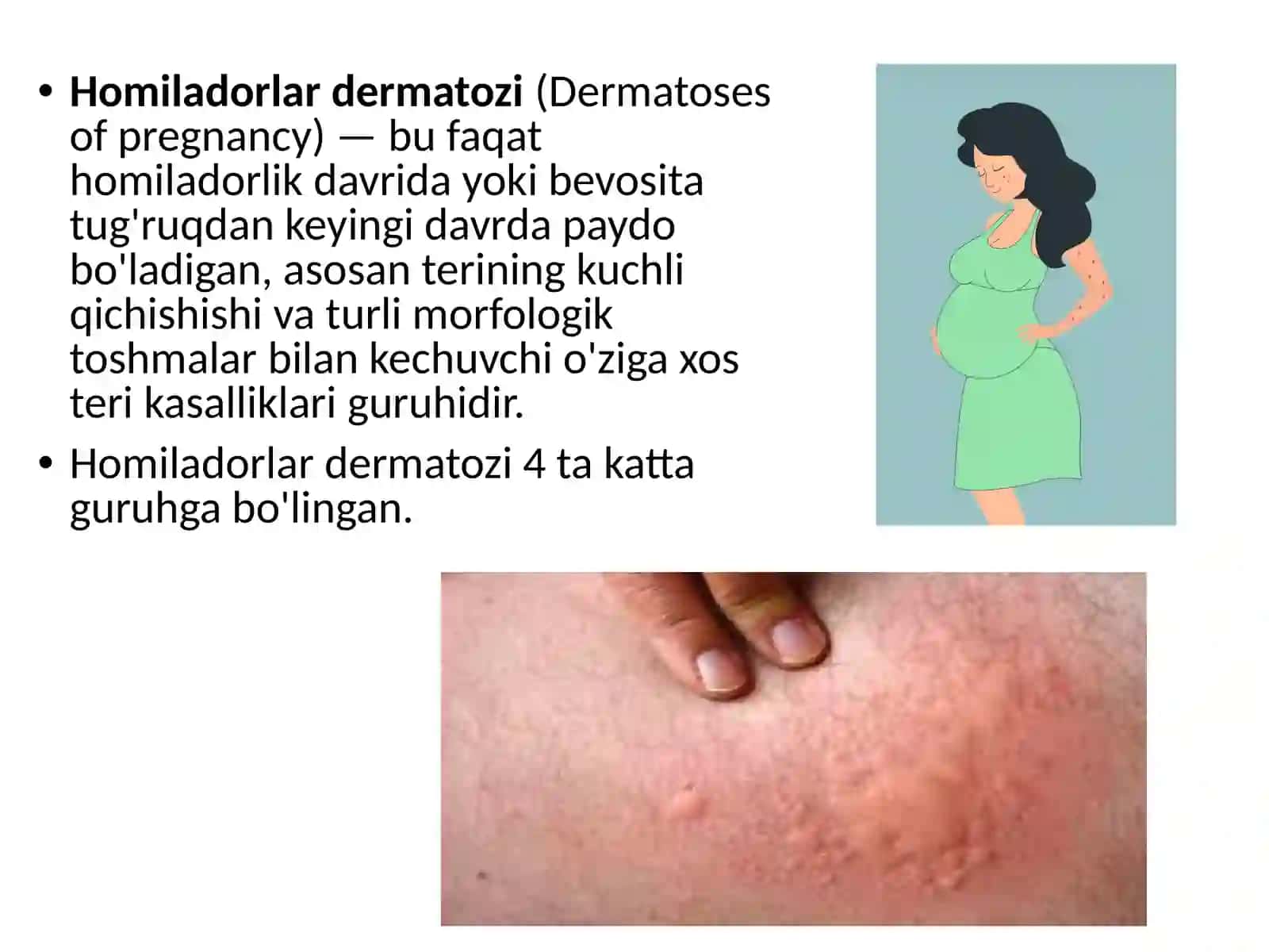 Homiladorlartoksikoziningkamuchraydiganturlari 3