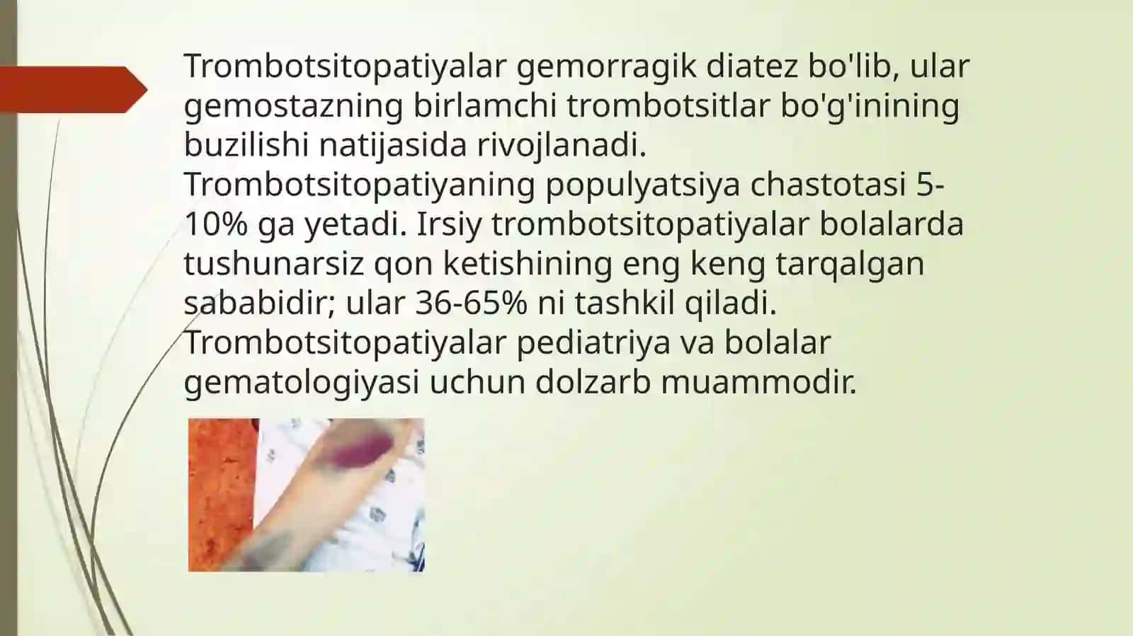Simptomatik trombositopatiyalar etiologiyasi, patogenezi, klinika, diagnostika, davolash prisiplari 3