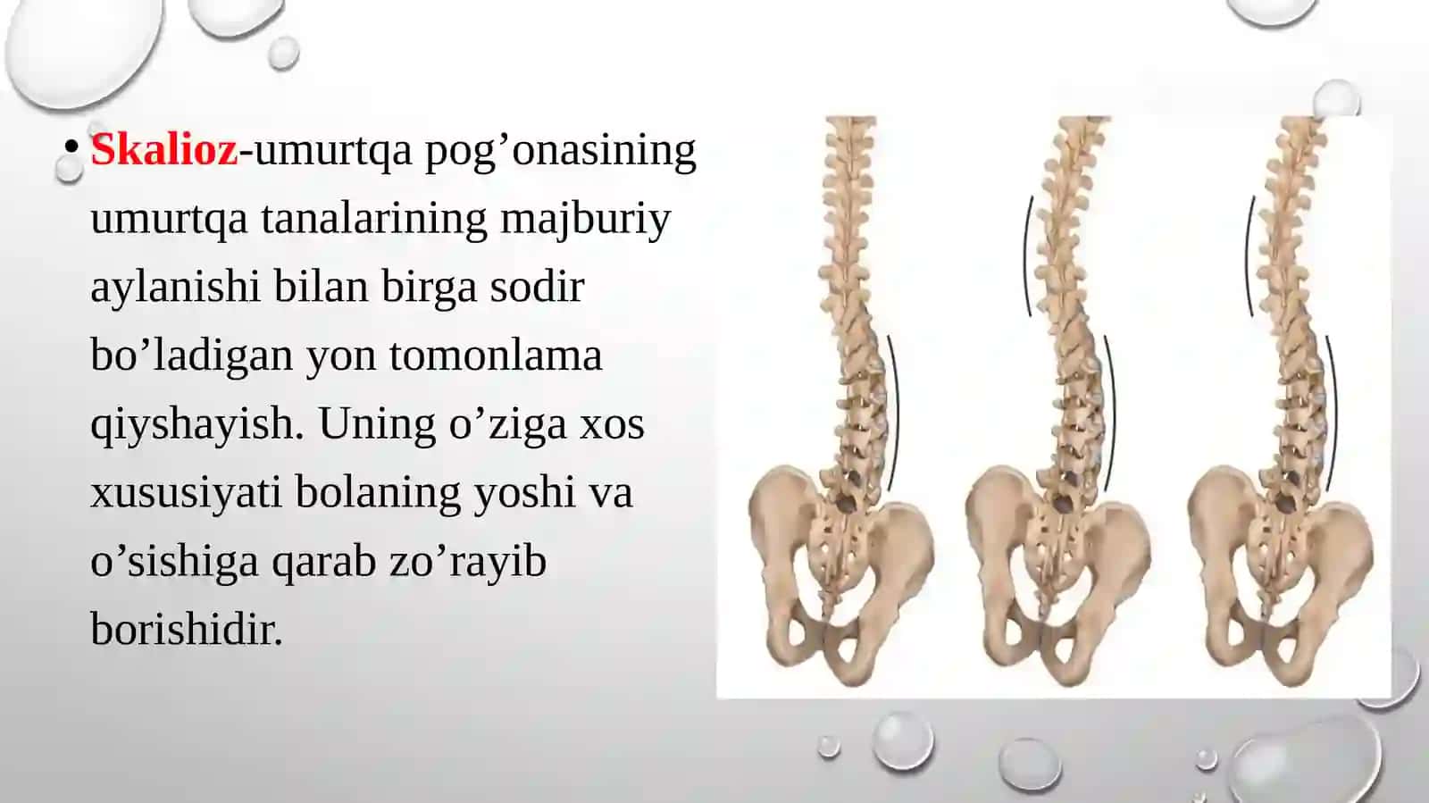 Skalioz kasalligi, tashxislash va kasallikni davolash usullari 3