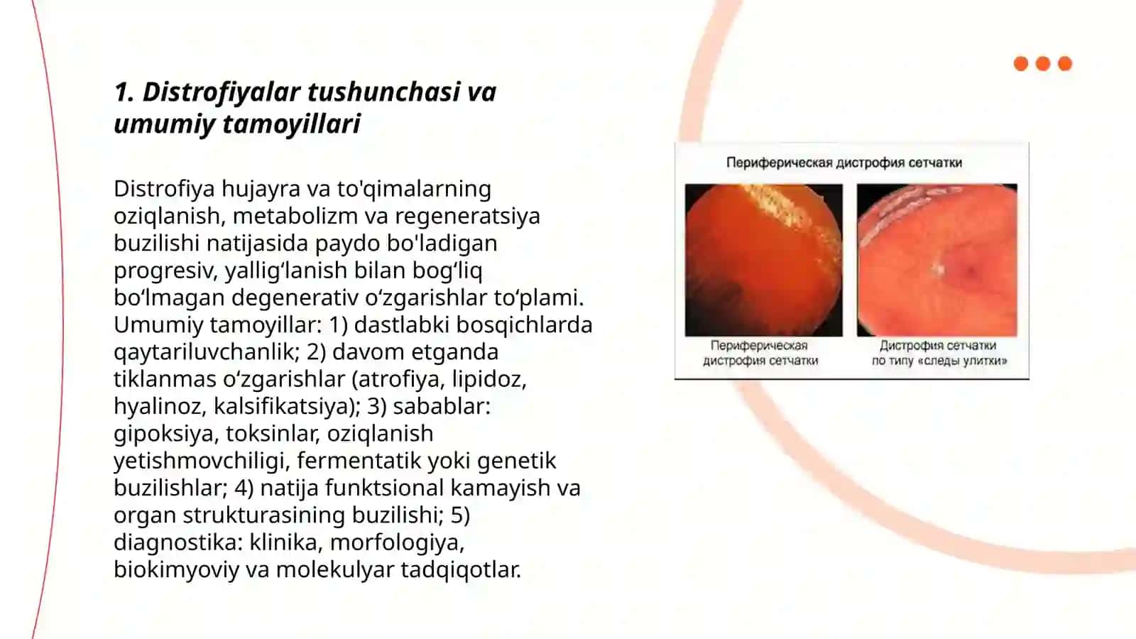Distrofiyalar.Parenximatoz va mezenximal distrofiyalar 3