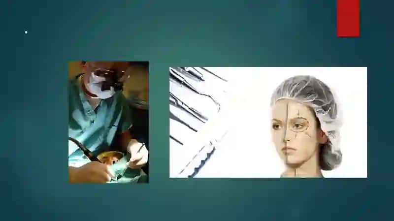 YUZDAGI PLASTIK OPERATSIYALAR 3