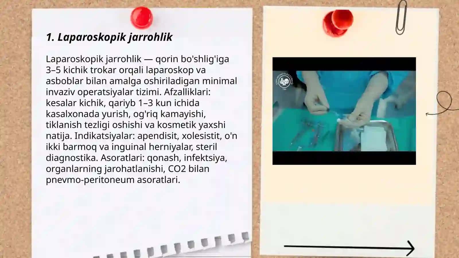 Laparoskopik jarrohlik 3