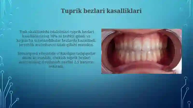 Splanxnologiya kirish og'iz boshligʻi tishlar Til so'lak bezlari yumshoq tanlay 3