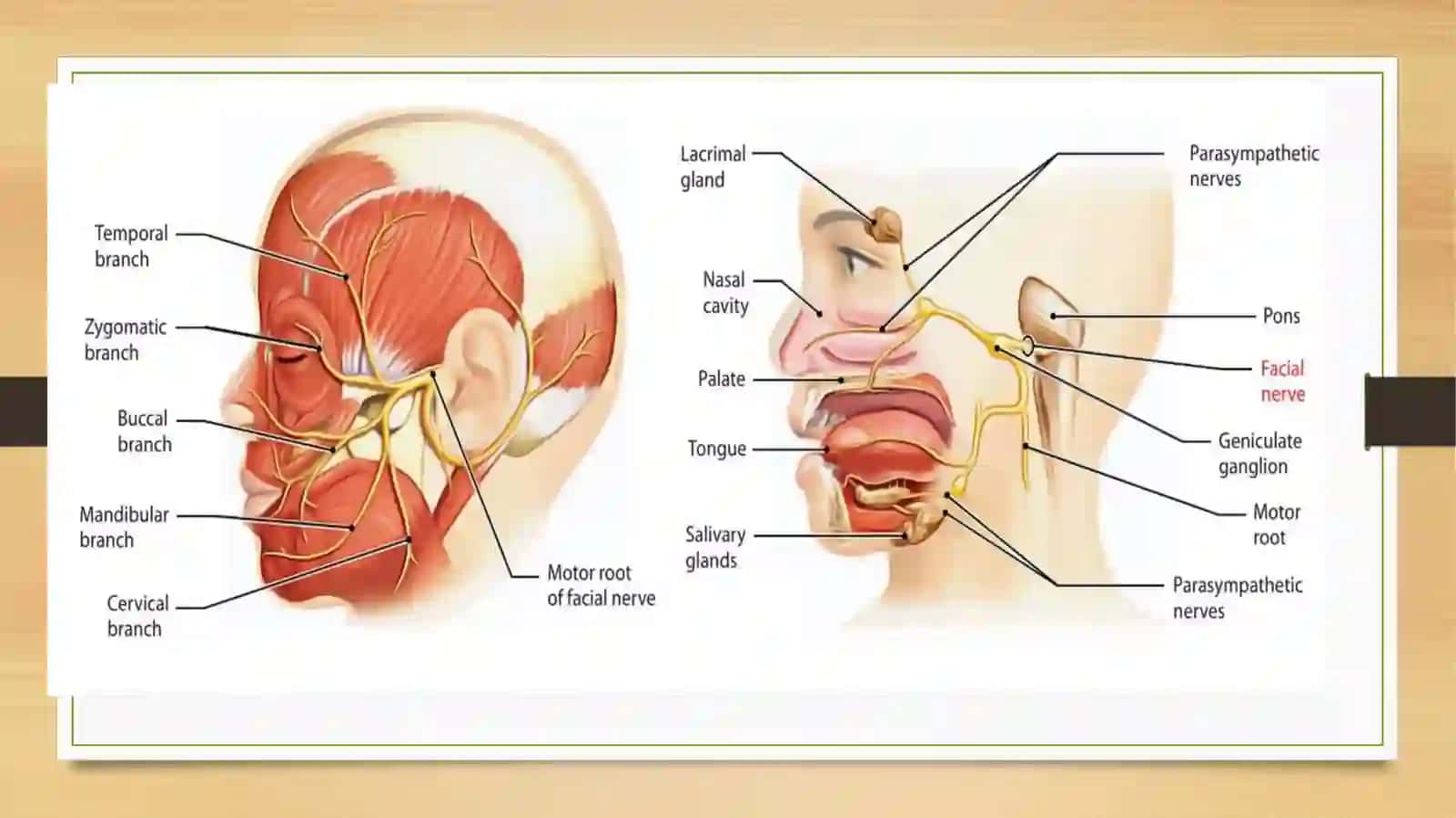 NERVUS FACIALIS 3