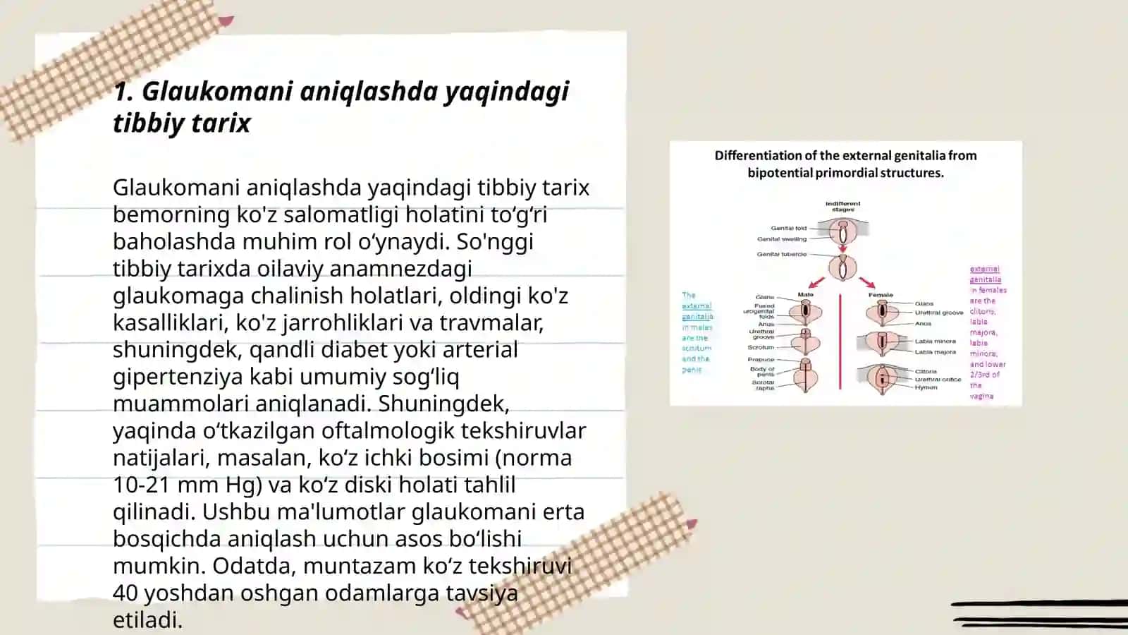 Ikkilamchi va asoratli glaukomani tashxisi va davolash usullari 3