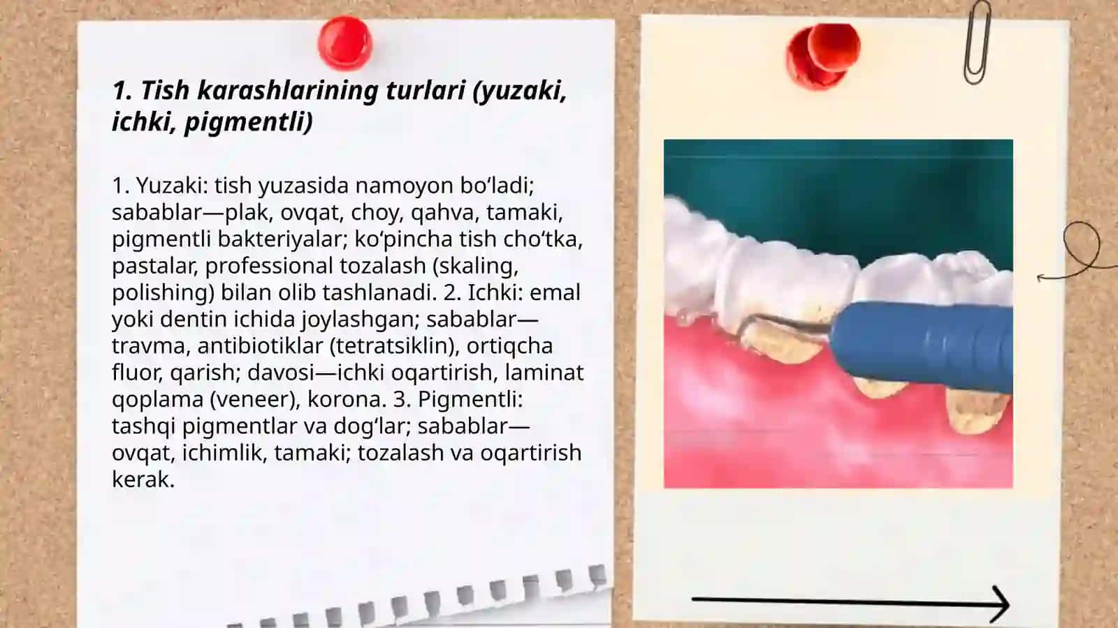 Tish karashlari va ularni tozalash 3