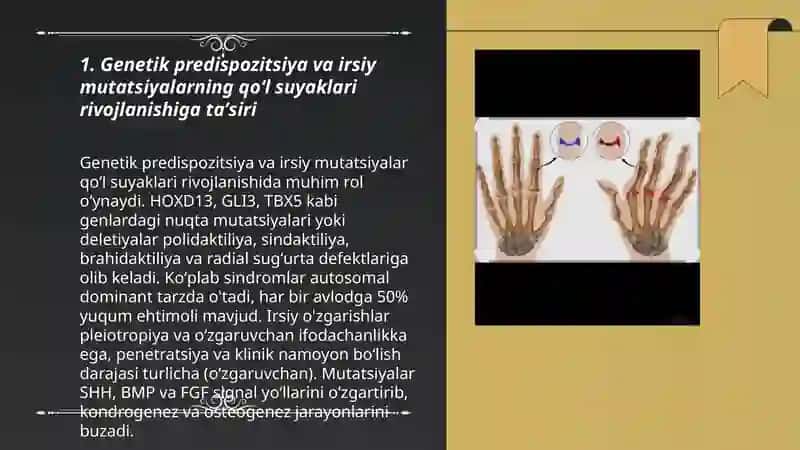 Qoʻl suyaklarining rivojlanish nuqsonlari 3