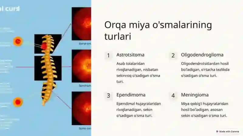 Orqa miya o'smalari va turlari 3