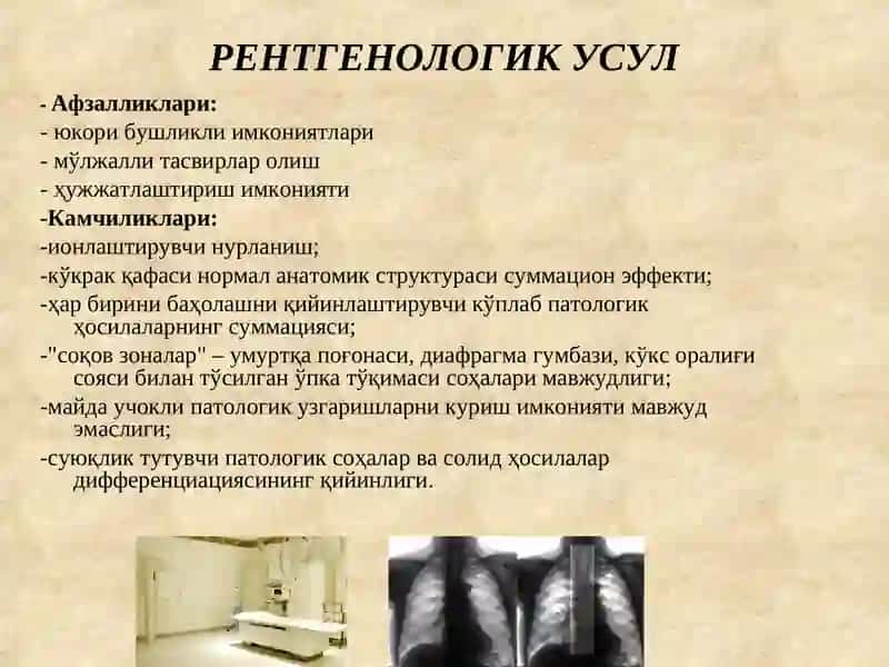 Нафас аъзолари касалликларининг комплекс нур диагностикаси 3