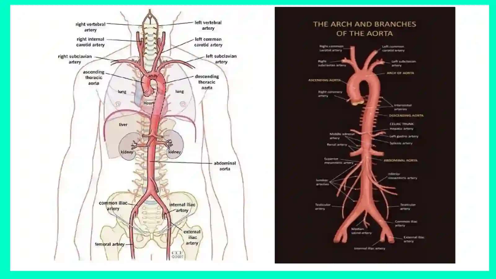 Aorta 3