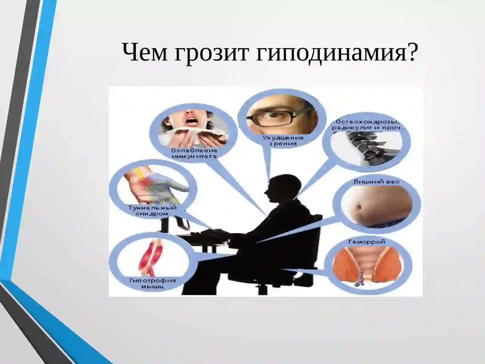 Гиподинамия 3
