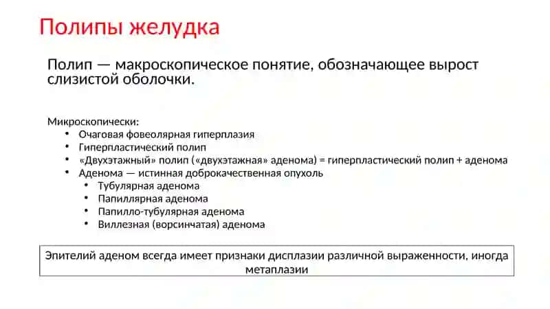 Опухоли желудка 3