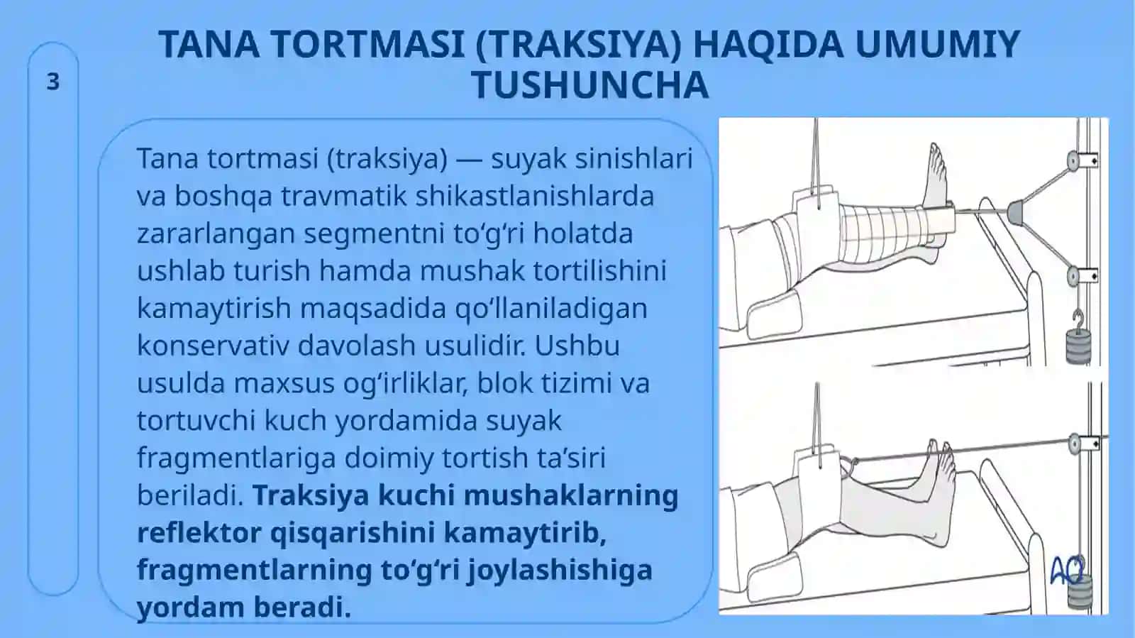 Tana tortmasi (skelet tortish usullari) 3