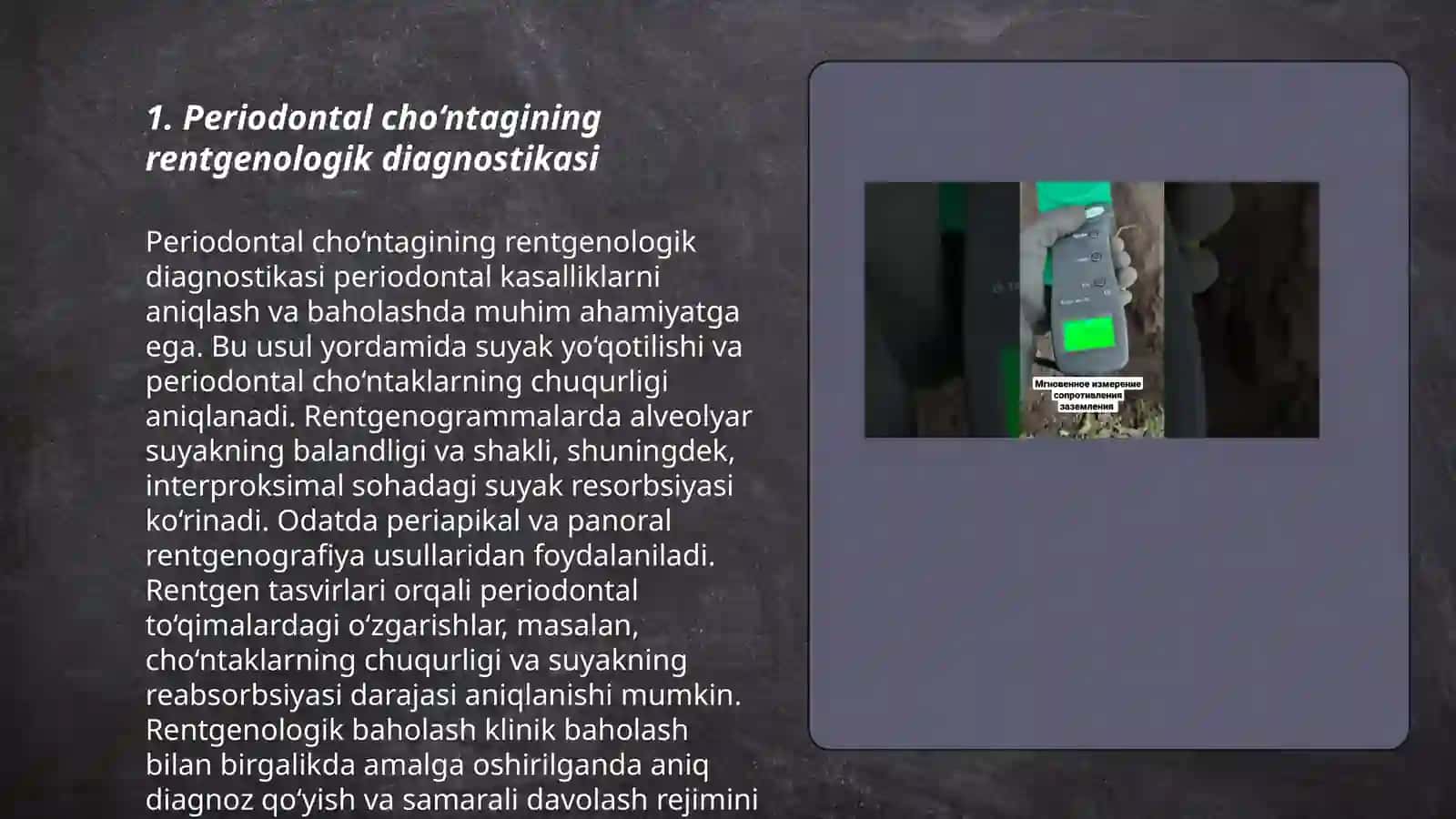 Periodontal cho‘ntagining rentgenologik diagnostikasi 3