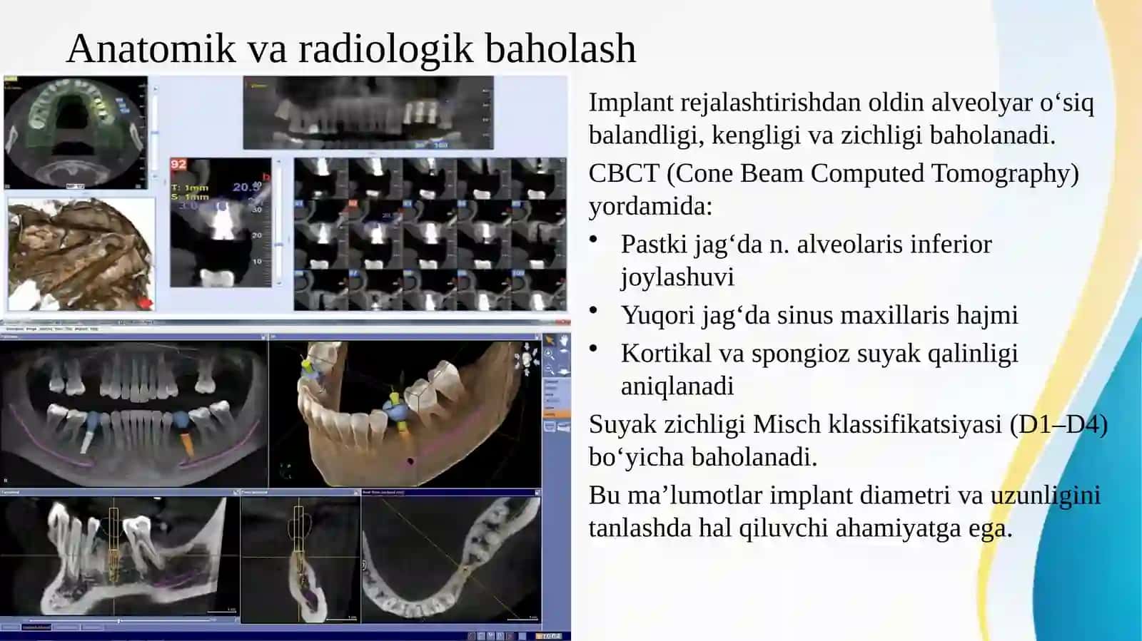 Umumiy amaliyot shifokori stomatologining zamonaviy klinik  protokollar asosida tish implantlaridan 3