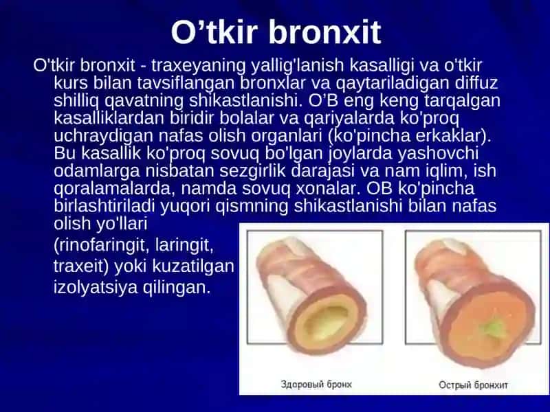 Bronxit kasalligi qo'zg'atuvchilari 3