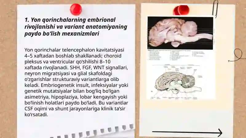 Yon qorinchalarning variant anatomiyasi klinik ahamiyati 3