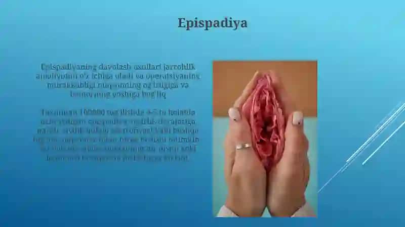 Moyakning yorg'oqqa tushish jarayoni va jinsiy a'zolarning rivojlanish nuqsonlari 3