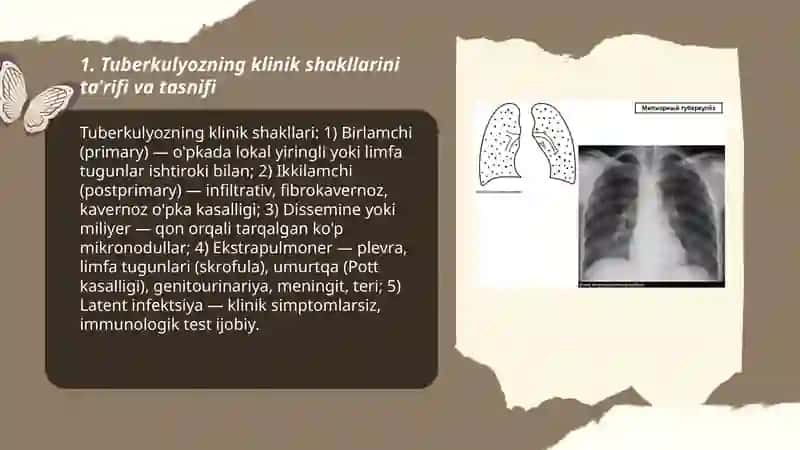 Tuberkulyoz klinik shakllarni qiyosiy tashhislashning 3